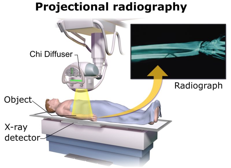 Real Life Fantasy: Microwaves and X-Rays - Brent Weeks